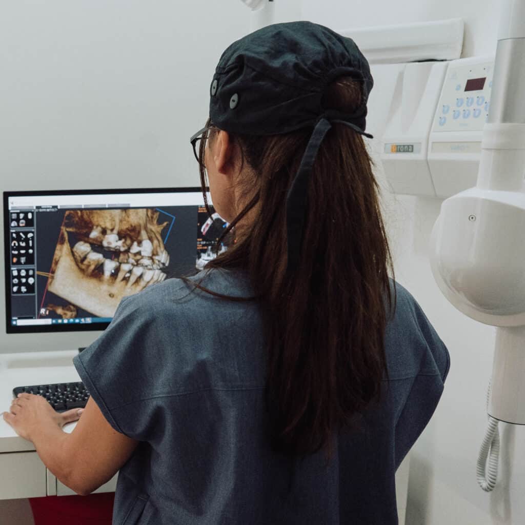 השתלת שיניים לפני אחרי