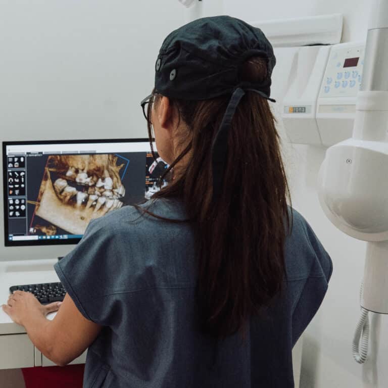 השתלת שיניים לפני אחרי